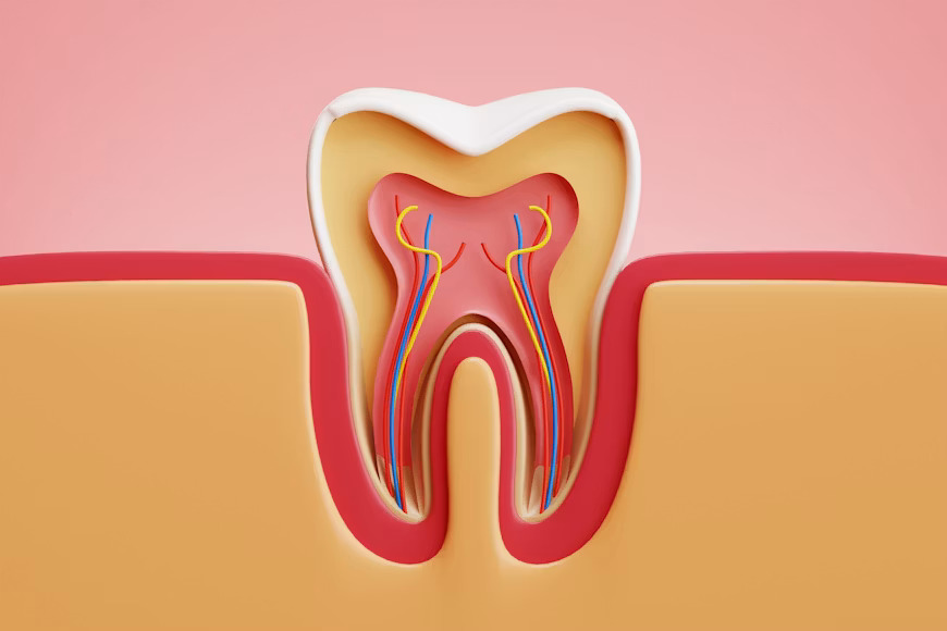 Root Canal Treatment