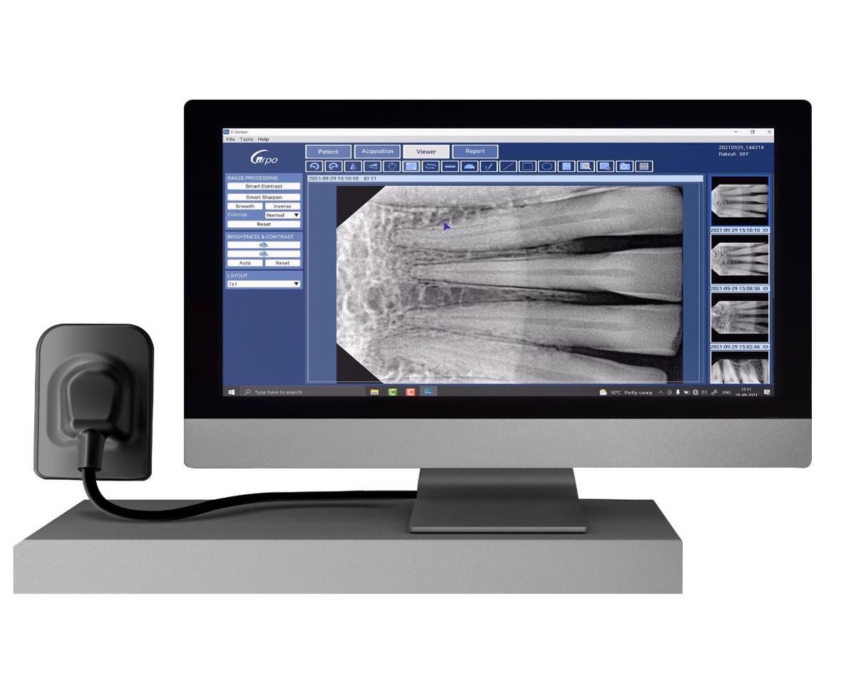 DIGITAL RVG X RAY