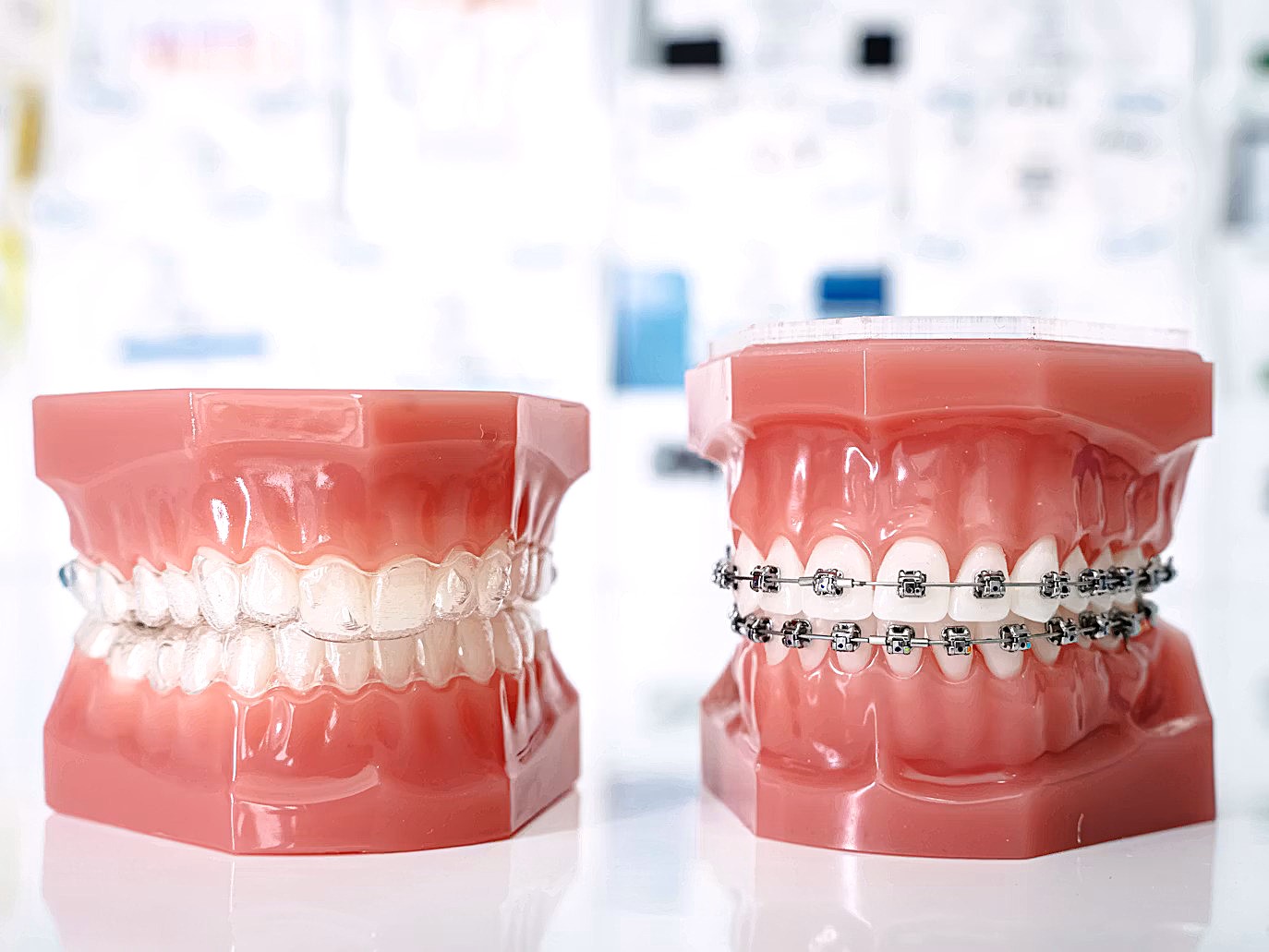Orthodontics(Aligners) & Braces
